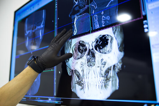 The male hand of the dentist on the monitor screen shows the jaw.