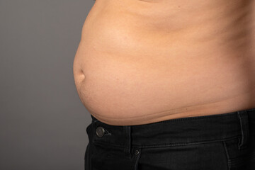 Bloated stomach close up