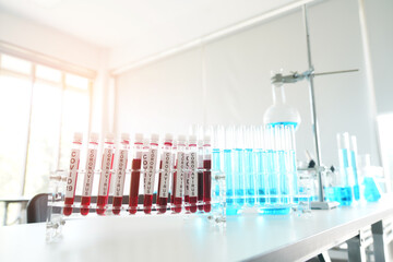 coronavirus covid 19 check, researchers are finding ways to eliminate the corona virus vaccine....