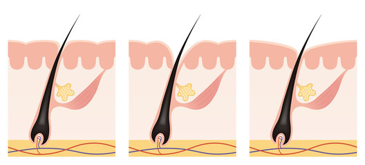Cross section of the skin 13 front No commentary