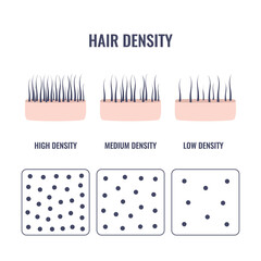 Hair density types chart of low, medium, high strand volume - obrazy, fototapety, plakaty
