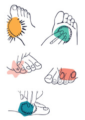 Common feet affections illustration set in graphic style,  black and white line art with colorful shapes to accentuate the problem. - 403002019