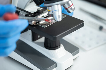 Young man using a microscope to see coronavirus (Covid-19) in a laboratory. He drops the dilution of blood samples in the glass. Researchers find a vaccine to prevent the virus.