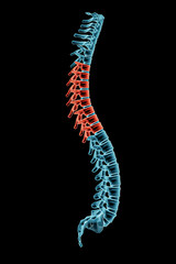 X-ray spinal column with kyphosis posture and pathological vertebrae highlighted in red. Human curvature of the spine disorder 3D rendering illustration.