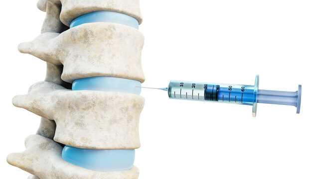 Close-up of intervertebral disk therapy injection. Syringe and human spinal column isolated on white background 3D rendering illustration. Medical and healthcare, medicine, anatomy concepts.