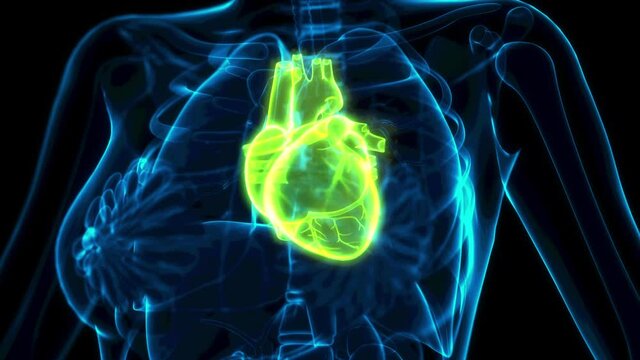 medical 3D animation, human heart problems x-ray image