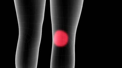 3d illustration of a children xray hologram showing pain area on the leg area