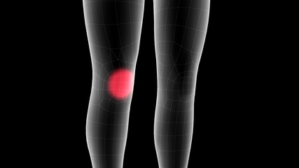 3d illustration of a children xray hologram showing pain area on the leg area