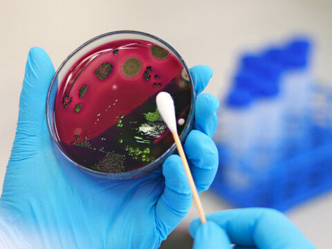 Scientist analysis Escherichia coli (E.coli) culture with Eosin Methylene Blue (EMB) Agar in Petri dish show the metallic green sheen colonies, hold in hands with nitrile gloves with swab test cotton.