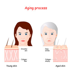Aging process. comparison of younger, and older skin.