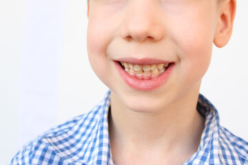 boy, kid smiling with open mouth, close up of child’s mouth, teeth, concept of child skin care, emotional development of elementary school students, dentistry