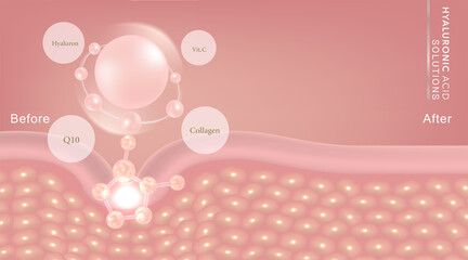 Hyaluronic acid before and after skin solutions ad, pink collagen serum drop with cosmetic advertising background ready to use, illustration vector.	