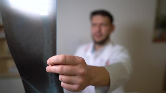 Doctor surgeon or pulmonologist at work in his office. Doctors hand holds an x-ray picture of the patient. Close portrait