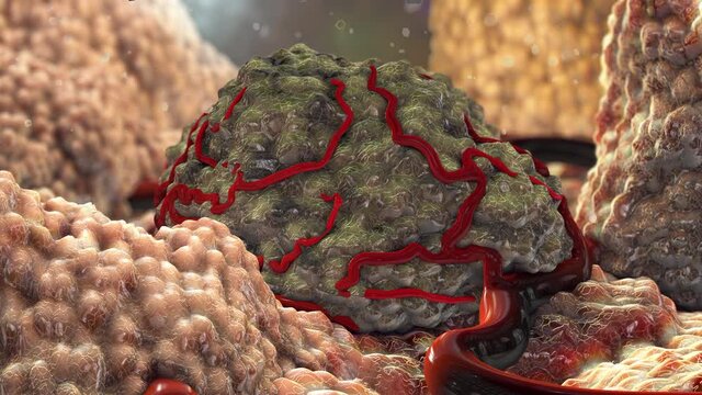 3D Tumor Cancer Cells