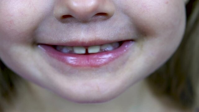 A little girl of two years shows her teeth. Close-up