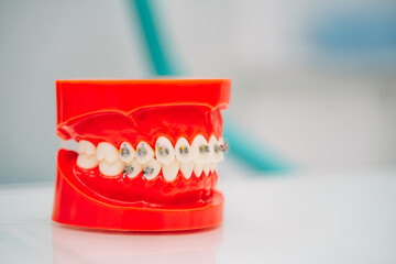 Mockup of a red dental jaw with braces in a dental clinic