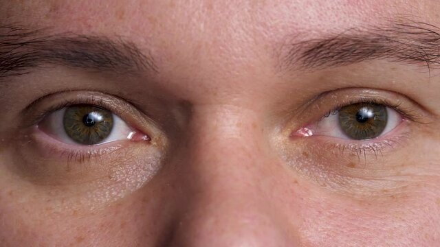 Male's hazel eyes, brown area surrounding pupil is iris. Wrinkle around eye is fold, ridge or crease on skin