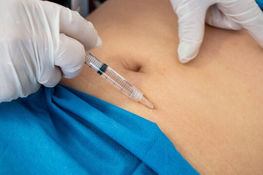 Mesoterapia