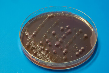 bacterial colonies   on  agar   medium petri dish plate plate on MacConkey agar