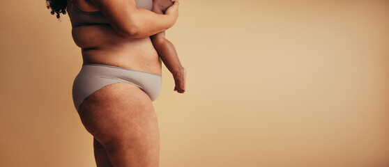 Embracing postpartum body