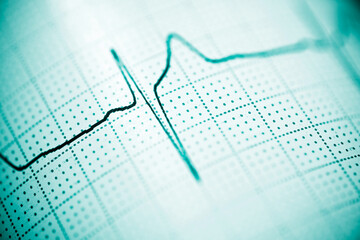 Electrocardiograph closeup view