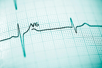 Electrocardiograph closeup view