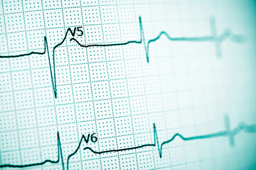 Electrocardiograph closeup view