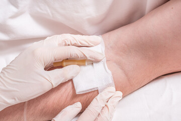 Close up man arm with Intravenous therapy