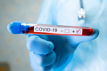 Fototapeta premium Positive blood infection sample in test tube for covid-19 coronavirus in lab. Scientist holding to check and analyze for patient in hospital.