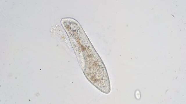 Paramecium caudatum is a genus of unicellular ciliated protozoan and Bacterium under the microscope