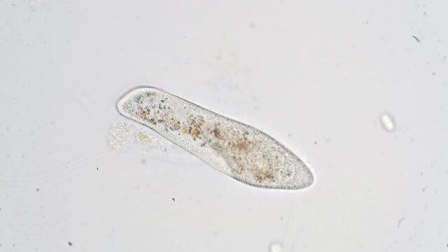 Paramecium caudatum is a genus of unicellular ciliated protozoan and Bacterium under the microscope