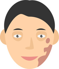 Human face with pigment birthmark short hair vector graphic clipart illustration or icon isolated