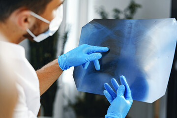 Male doctor examines an x-ray of lungs in hospital