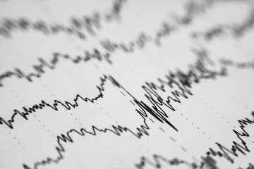 EEG wave form of the pediatric patients, problems in the electrical activity of the brain.Abnormal...