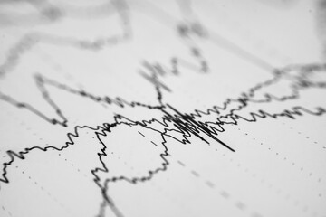 EEG wave form of the pediatric patients, problems in the electrical activity of the brain.Abnormal EEG.