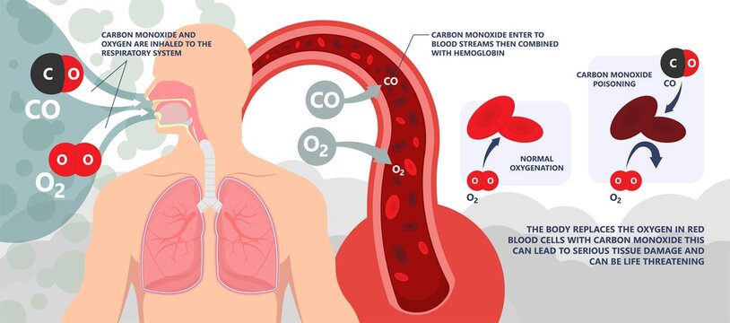 CO Level Chest Pain Loss Of Consciousness Gas Death Cherry Red Skin Cyanide Toxicity Motor Car Fuel  Methylene Chloride Blood Prevent Alarm Oxygen Toxic Harmful Danger Device Detect Safety Silent Leak