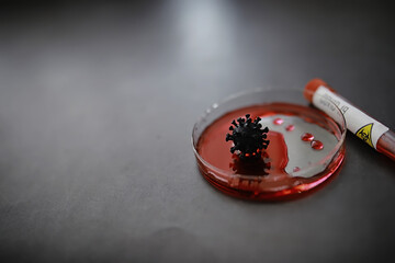 Test tube with patient blood for testing. Analysis for the virus. Coronavirus pandemic laboratory...