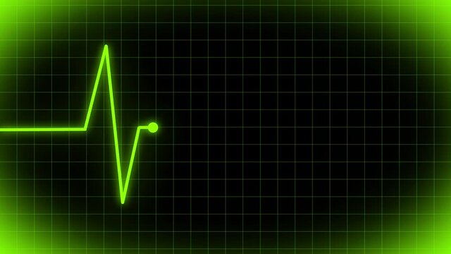 heart beat wave monitor graph loop animation