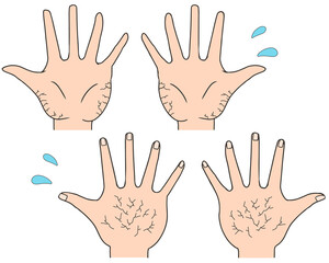 Obraz premium 手 ひび割れ