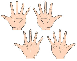 手　高齢者　バリエーション