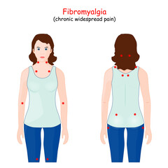 fibromyalgia tender point