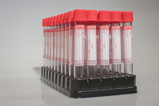 Pack Of Test Tubes In Laboratory