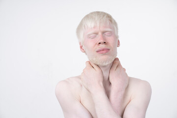 albinism albino man in  studio dressed t-shirt isolated on a white background. abnormal deviations. unusual appearance