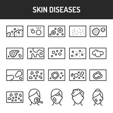 Skin diseases black line icons set. Isolated vector element. Outline pictograms for web page, mobile app, promo