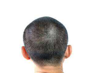 Gray hair problems in men, asian man with gray hair, white hair or hair loss problem.