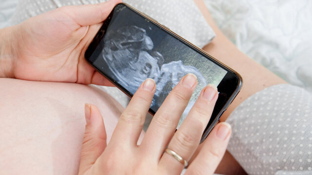 Closeup of pregnant woman holding smartphone and looking on ultrasound image of her unborn baby in belly. Concept of expecting baby, pregnancy and healthcare.