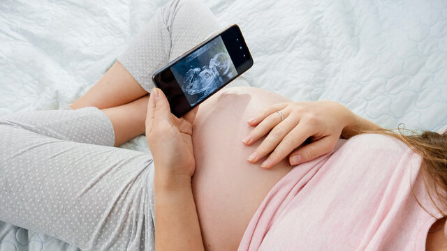 Top view of pregnant woman holding smartphone and looking on ultrasound image of her unborn baby in belly. Concept of expecting baby, pregnancy and healthcare.