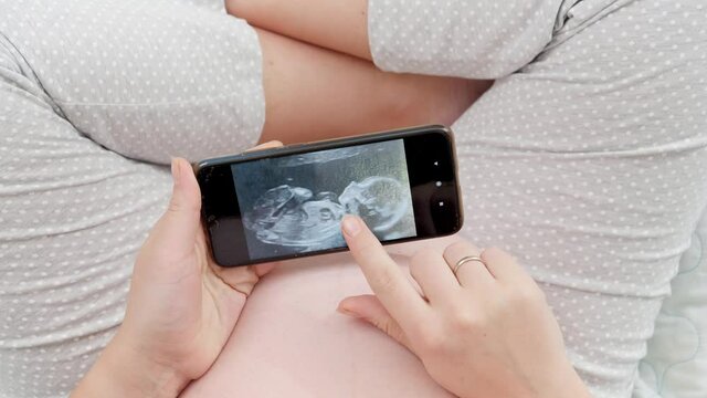Top view of pregnant woman sitting on bed and looking on ultrasound image of her unborn baby on smartphone