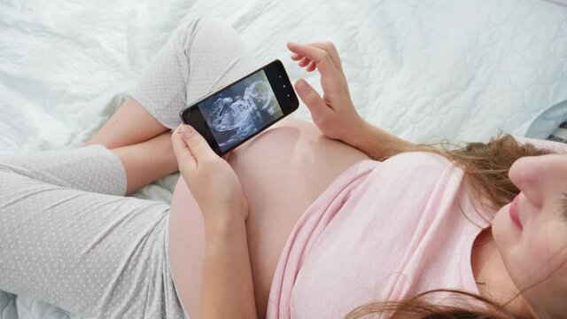 Young pregnant woman in pajamas browsing ultrasound image of her unborn baby. Concept of expecting baby, pregnancy and healthcare.