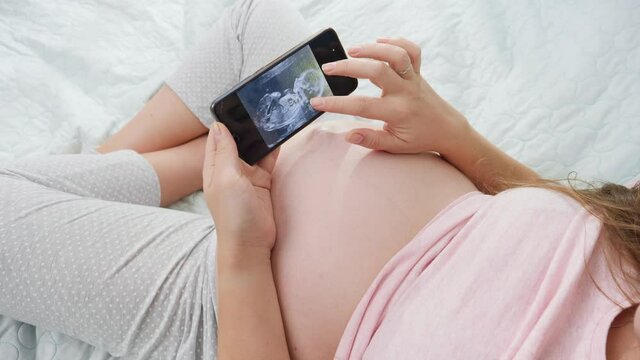 Closeup of pregnant woman looking on ultrasound image of her unborn child and stroking big belly. Concept of expecting baby, pregnancy and healthcare.